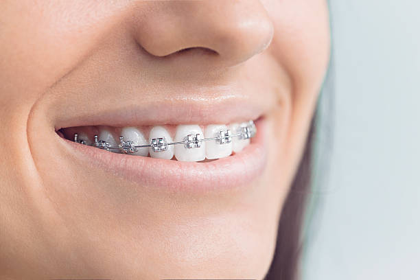 Best Dental Fillings (Composite and Amalgam)  in Big Bend, WI